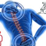 Beyin ve Omurga Cerrahisinde Hasta Profili Değişti: Genç Yaşta Ameliyatlar Artıyor