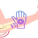 Bilgisayar Başında Çalışanlarda Kubital Tünel Sendromu Riski ve Korunma Yolları