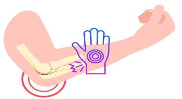 Bilgisayar Başında Çalışanlarda Kubital Tünel Sendromu Riski ve Korunma Yolları